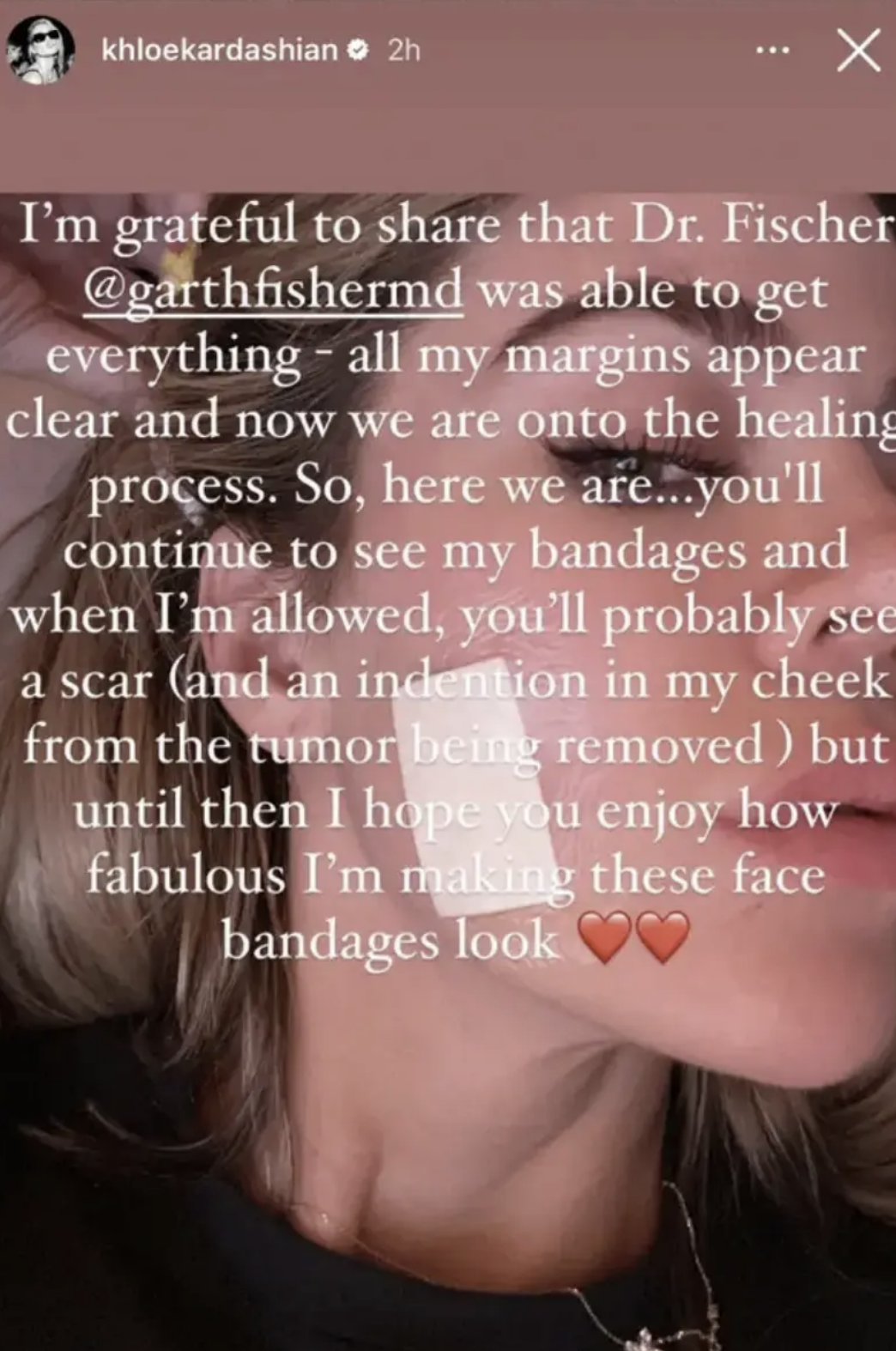 Khloe Kardashian sharing an update on healing process post-tumor removal, expressing gratitude and mentioning a scar and face bandages